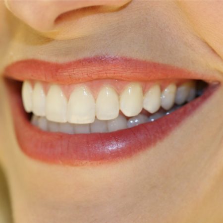 Improve Your Smile With Dental Contouring